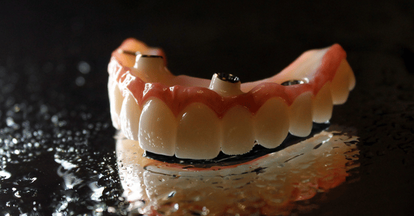 implant dentist Knoxville - Farragut sc