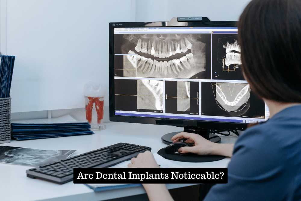Are Dental Implants Noticeable?