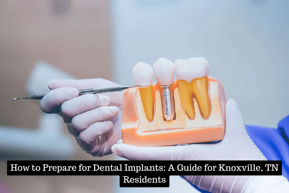 How to Prepare for Dental Implants A Guide for Knoxville, TN Residents
