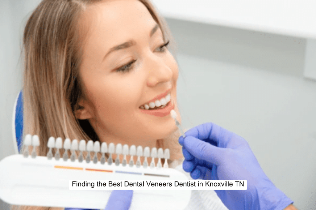 Finding the Best Dental Veneers Dentist in Knoxville TN