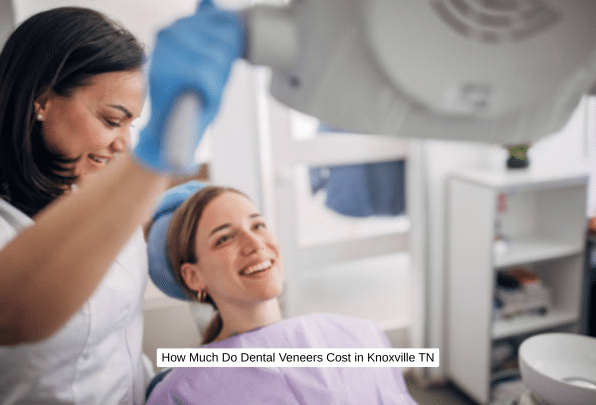 How Much Do Dental Veneers Cost in Knoxville TN