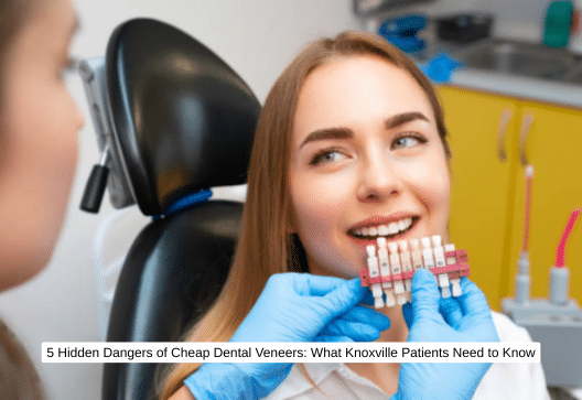 5 Hidden Dangers of Cheap Dental Veneers What Knoxville Patients Need to Know