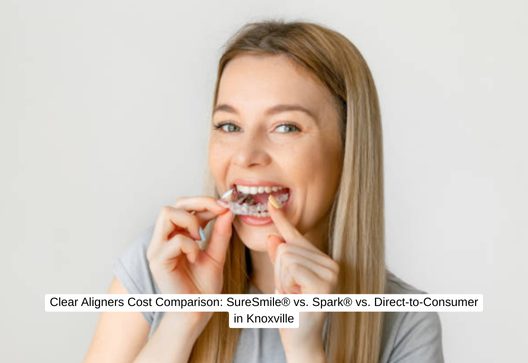 Clear Aligners Cost Comparison: SureSmile® vs. Spark® vs. Direct-to-Consumer in Knoxville